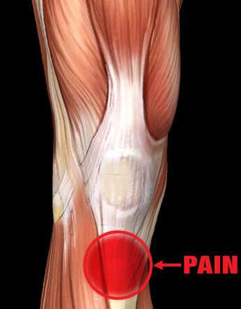 Osgood-Schlatter