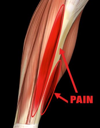 Benhinneinflammation